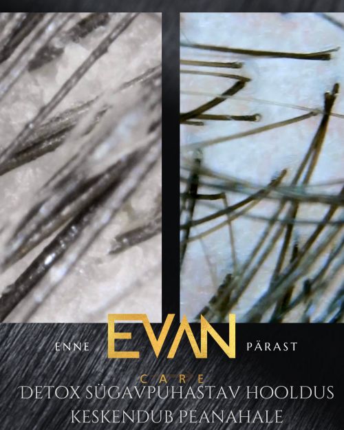 PEANAHA JA JUUSTE DETOX SÜGAVPUHASTAV RAVIHOOLDUS-VOUCHER